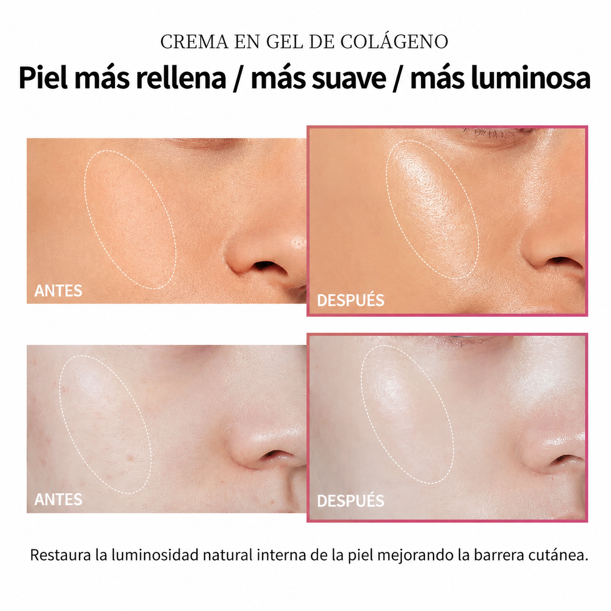 Crema en gel de colágeno (100 ml) con niacinamida: reafirmante, calmante, hidratante y antiedad; cuidado de la piel y gel facial.